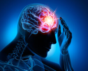 How Zaner Harden Law Can Help If You’ve Suffered a Brain Injury in Denver, CO